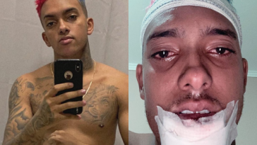 Depois de desativar Instagram em razão dos haters, Mc Brinquedo volta à rede para mostrar rosto após acidente de moto. Foto: Instagram
