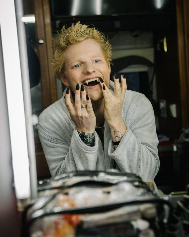 Ed Sheeran reclama de unhas de clipe: "pesadelo para mijar"