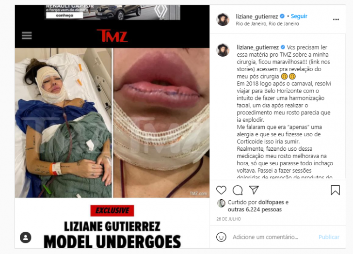 Imagens Fortes Veja O Antes E Depois De Liziane Gutierrez De A Fazenda POPline