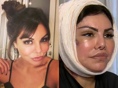 Imagens Fortes Veja O Antes E Depois De Liziane Gutierrez De A Fazenda Popline