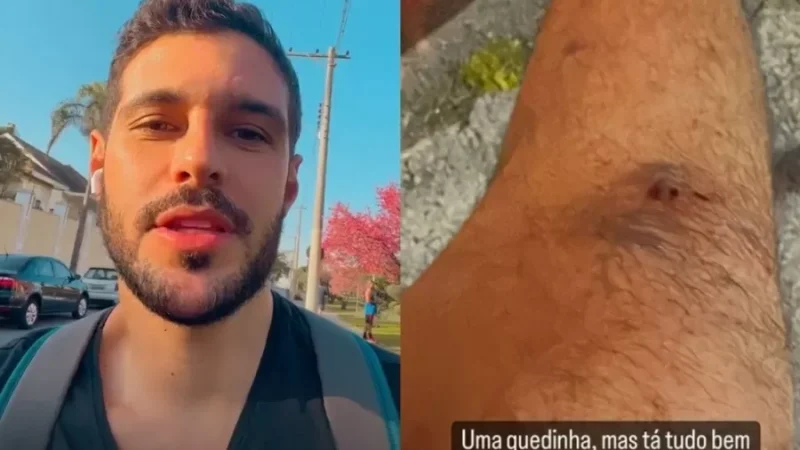 Rodrigo Mussi, do BBB22, tranquiliza após cair de bicicleta