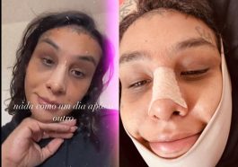 Linn da Quebrada atualiza fãs após cirurgia de afirmação de gênero